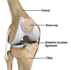 ACL Reconstruction