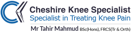 cheshire-knee-specialist